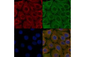 ABIN6257505 and ABIN6276213 staining Hela cells by IF/ICC. (SCTR 抗体  (Internal Region))