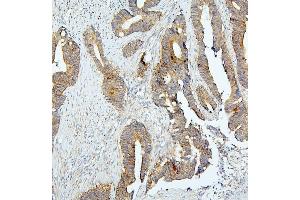 IHC analysis of BUB1B using anti-BUB1B antibody (ABIN7600962). (BUB1B 抗体  (AA 26-448))