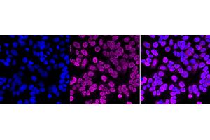 Immunocytochemical staining of HAP-1 cells with PTBP1 antibody (ABIN7799882), 1:1,000).