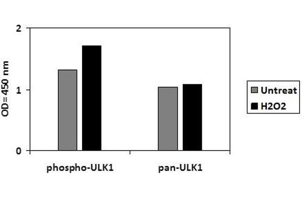 ULK1 ELISA 试剂盒