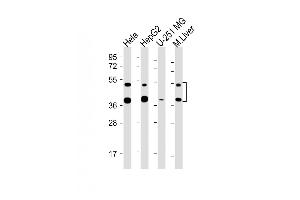 All lanes : Anti-FDPS Antibody (Center) at 1:2000-1:4000 dilution Lane 1: Hela whole cell lysate Lane 2: HepG2 whole cell lysate Lane 3: U-251 MG whole cell lysate Lane 4: Mouse Liver lysate Lysates/proteins at 20 μg per lane. (FDPS 抗体)