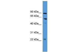 WB Suggested Anti-PDZK1 Antibody Titration:  0. (PDZK1 抗体  (N-Term))
