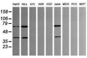 Image no. 1 for anti-tRNA Methyltransferase 2 Homolog A (TRMT2A) antibody (ABIN1501515) (TRMT2A 抗体)