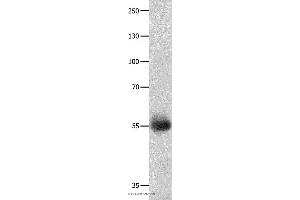 Western blot analysis of Human ovarian cancer tissue, using DRD5 Polyclonal Antibody at dilution of 1:800 (DRD5 抗体)
