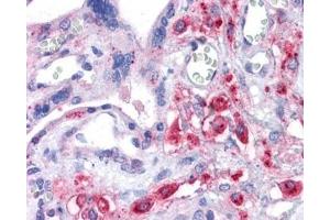 IHC testing of FFPE human placental tissue with XCT antibody at 3. (SLC7A11 抗体)