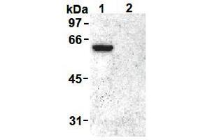 Western Blotting (WB) image for anti-Vimentin (VIM) (pSer55) antibody (ABIN1109485) (Vimentin 抗体  (pSer55))