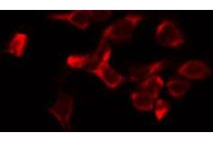 ABIN6274547 staining HeLa by IF/ICC. (JIP3 抗体  (Internal Region))