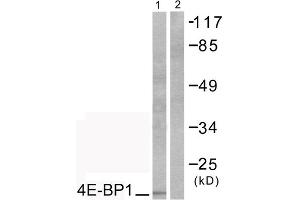 Western blot analysis of extracts from COS7 cells, treated with EGF (200ng/ml, 30mins), using 4E-BP1 (epitope around residue 69) antibody (ABIN5976164). (eIF4EBP1 抗体  (Thr70))