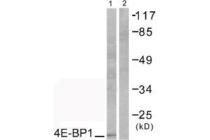 Western blot analysis of extracts from COS7 cells, treated with EGF (200ng/ml, 30mins), using 4E-BP1 (epitope around residue 69) antibody (ABIN5976164).
