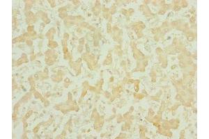 Immunohistochemistry of paraffin-embedded human liver tissue using ABIN7159686 at dilution of 1:100 (CHCHD3 抗体  (AA 1-227))