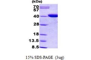 CPOX Protein (AA 111-454) (His tag)