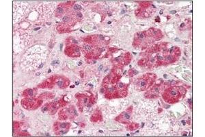 Immunohistochemistry (IHC) image for anti-5'-Nucleotidase, Ecto (CD73) (NT5E) (AA 27-252) antibody (ABIN238367) (CD73 抗体  (AA 27-252))