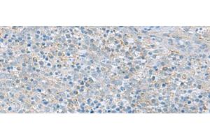 Immunohistochemistry of paraffin-embedded Human tonsil tissue using PYCR2 Polyclonal Antibody at dilution of 1:40(x200) (PYCR2 抗体)