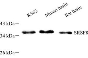 Western blot analysis of SRSF8 (ABIN7075558),at dilution of 1: 800 (SFRS2B 抗体)