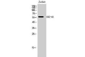 Western Blotting (WB) image for anti-CCZ1 Vacuolar Protein Trafficking and Biogenesis Associated Homolog (S. Cerevisiae) (CCZ1) (C-Term) antibody (ABIN3174373) (CCZ1 抗体  (C-Term))