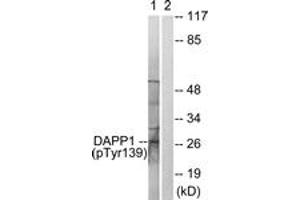 Western blot analysis of extracts from 293 cells treated with Insulin 0.