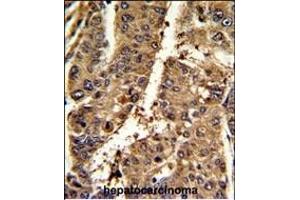 Immunohistochemistry (Paraffin-embedded Sections) (IHC (p)) image for anti-Proteasome (Prosome, Macropain) Activator Subunit 2 (PA28 Beta) (PSME2) (AA 210-239), (C-Term) antibody (ABIN390645)