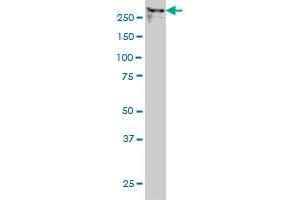 TPR monoclonal antibody (M01), clone 1A8 Western Blot analysis of TPR expression in Hela NE (TPR 抗体  (AA 1-98))