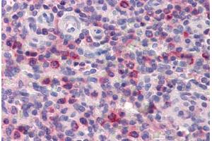 Human Spleen (formalin-fixed, paraffin-embedded) stained with ONECUT1 antibody ABIN462211 followed by biotinylated goat anti-rabbit IgG secondary antibody ABIN481713, alkaline phosphatase-streptavidin and chromogen. (ONECUT1 抗体  (C-Term))