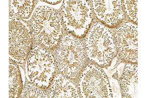 ABIN7094437 and ABIN7098485 at 1/100 staining Rat testis tissue by IHC-P. (STRA8 抗体  (Internal Region))