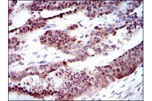 Immunohistochemistry (IHC) image for anti-Cytochrome P450, Family 1, Subfamily A, Polypeptide 1 (CYP1A1) antibody (ABIN1846449) (CYP1A1 抗体)