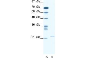 WB Suggested Anti-TRPM3 Antibody Titration:  0. (TRPM3 抗体  (N-Term))