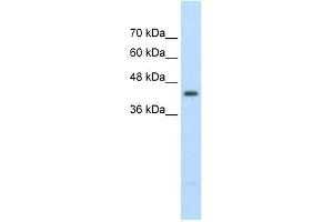 WB Suggested Anti-UPB1 Antibody Titration:  2. (UPB1 抗体  (Middle Region))