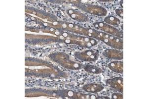 Immunohistochemical staining of human duodenum with FAM136A polyclonal antibody  shows moderate cytoplasmic positivity in glandular cells at 1:200-1:500 dilution. (FAM136A 抗体)