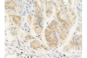 ABIN6256675 and ABIN6267240 at 1/100 staining human normal gastric tissue by IHC-P. (JAK2 抗体  (pTyr221))