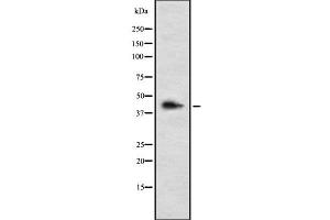 Western blot analysis of LHX3 using HepG2 whole cell lysates (LHX3 抗体  (C-Term))