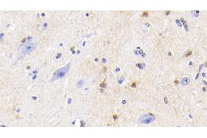 Detection of S100 in Bovine Cerebellum Tissue using Polyclonal Antibody to S100 Calcium Binding Protein (S100) (S100 Protein (S100) (AA 1-94) 抗体)