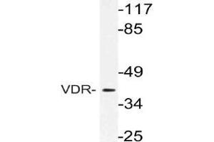 Western blot (WB) analysis of VDR antibody in extracts from Jurkat cells. (Vitamin D Receptor 抗体)