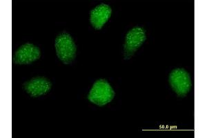 Immunofluorescence of purified MaxPab antibody to MGC16943 on HeLa cell. (ERI2 抗体  (AA 1-328))