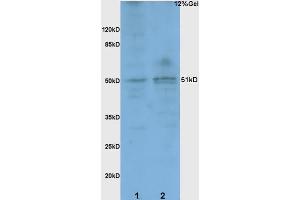 L1 rat brain lysates probed with Anti BACE1/ASP2 Polyclonal Antibody, Unconjugated (ABIN725705) at 1:200 overnight at 4 °C. (BACE1 抗体  (AA 401-501))