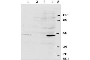 Western-Blot analysis of HPV-11 E2 protein. (Human Papilloma Virus 11 E2 (HPV-11 E2) (AA 202-284) 抗体)