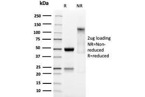SDS-PAGE (SDS) image for anti-SRY (Sex Determining Region Y)-Box 9 (SOX9) (AA 393-508) antibody (ABIN6940622)