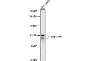 Western blot analysis of extracts of Rat brain, using HNRNPM antibody (ABIN7267635) at 1:1000 dilution. (HNRNPM 抗体)