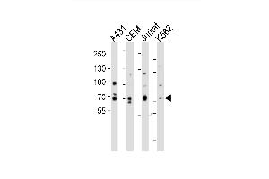 Western blot analysis of lysates from A431, CEM, Jurkat, K562 cell line (from left to right), using ITK Antibody (Center) (ABIN6243870 and ABIN6577737). (ITK 抗体  (AA 228-262))