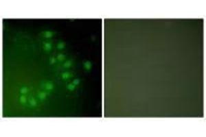 Immunofluorescence analysis of A549 cells, using p63 antibody. (p63 抗体)