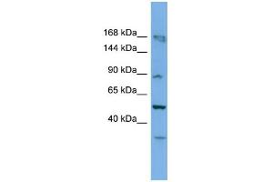 Western Blotting (WB) image for anti-TATA Box Binding Protein (TBP)-Associated Factor, RNA Polymerase I, C, 110kDa (TAF1C) (C-Term) antibody (ABIN2778623)