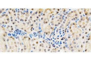 Immunohistochemistry of paraffin-embedded Mouse kidney using LGALS3 Polyclonal Antibody at dilution of 1:200 (40x lens). (Galectin 3 抗体)