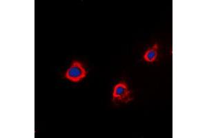 Immunofluorescent analysis of PTTG1IP staining in A549 cells. (PTTG1IP 抗体  (Center))