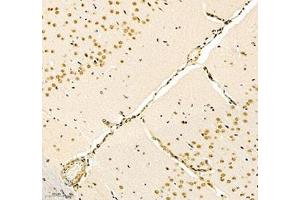 Immunohistochemistry (Paraffin-embedded Sections) (IHC (p)) image for anti-Notch 3 (NOTCH3) antibody (ABIN7074862)