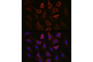 Immunofluorescence analysis of NIH/3T3 cells using GAPDH Mouse mAb (ABIN3020540, ABIN3020541, ABIN3020542 and ABIN1512934) at dilution of 1:100 (40x lens). (GAPDH 抗体)