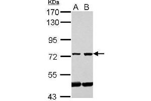 WB Image Sample (30 ug of whole cell lysate) A: Jurkat B: Raji 7. (GLMN 抗体)