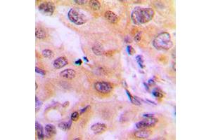Immunohistochemistry (IHC) image for anti-Cytochrome P450, Family 2, Subfamily J, Polypeptide 2 (CYP2J2) (Center) antibody (ABIN7295456)