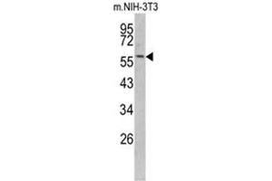 Western blot analysis of KRT14 antibody (Center) in NIH-3T3 cell line lysates (35ug/lane). (KRT14 抗体  (Middle Region))