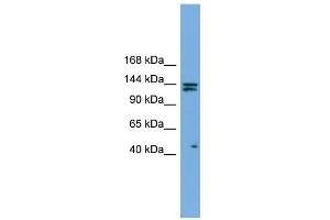 WB Suggested Anti-IARS Antibody Titration: 0. (IARS 抗体  (Middle Region))