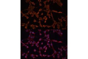 Immunofluorescence (IF) image for anti-ATP-Binding Cassette, Sub-Family B (MDR/TAP), Member 11 (ABCB11) (AA 600-750) antibody (ABIN6136348)