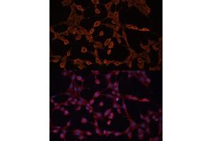 Immunofluorescence analysis of NIH-3T3 cells using  Polyclonal Antibody (ABIN6129850, ABIN6136348, ABIN6136349 and ABIN6224537) at dilution of 1:100 (40x lens). (ABCB11 抗体  (AA 600-750))